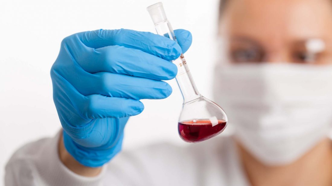 Sources of error in lab experiments and laboratory tests Felixtrument